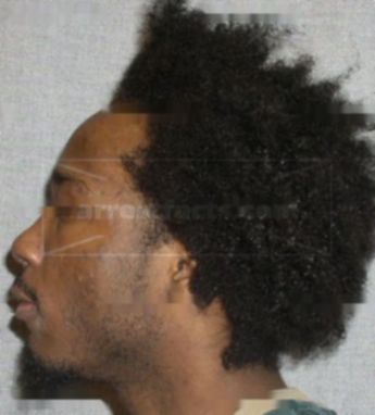 Jermaine Turner