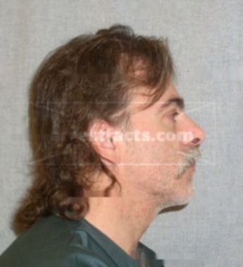 Patrick Anthony Baugh