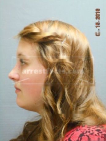 Brooke L Schwabenlender