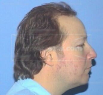 Richard Milam