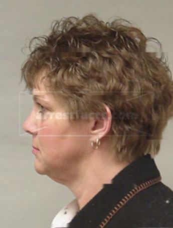 Teresa S Schaetz