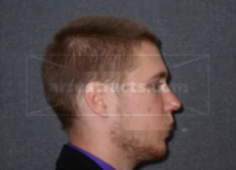 Adam Kossow