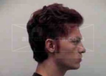 Alexander M Mckenney