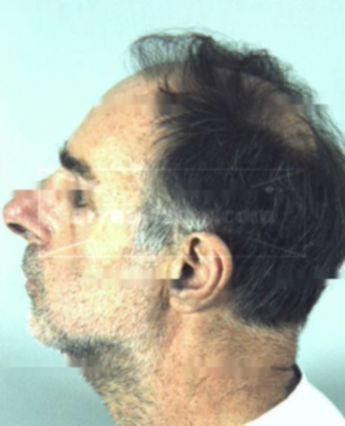 Robert A Muniza