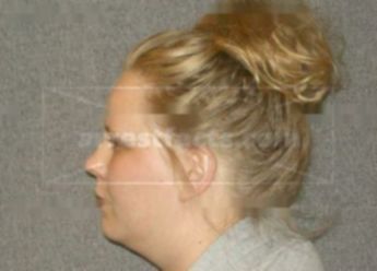 Magen M Eggers