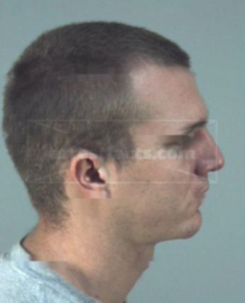 Todd Allen Million