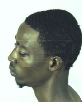 Melford Nehemiah Foster Jr.