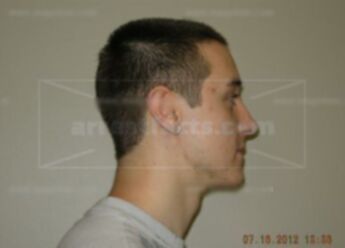 Dominick J Demitro