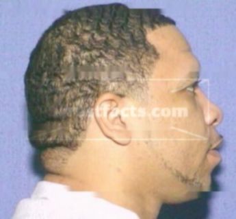 Robert Nmi Billings