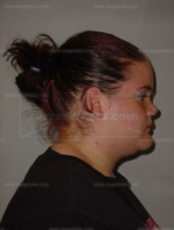 Nicole L Benzine
