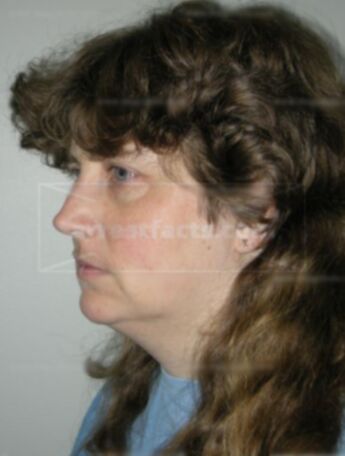 Carol A Stone