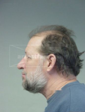 Steven J Bresler