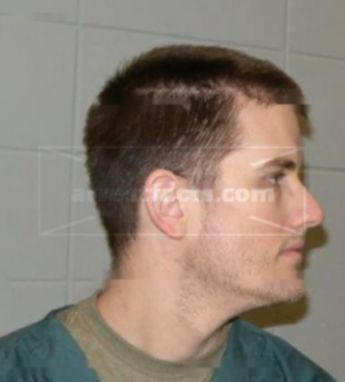 Troy B Birkenmeier