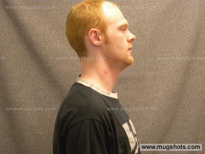 Joshua M Gadke