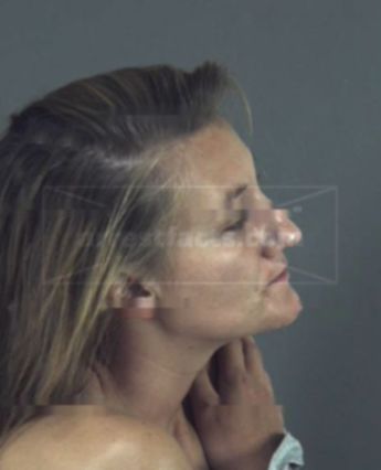 Lisa Carlotta Long