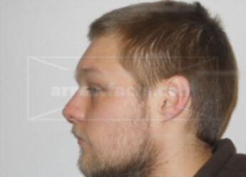 Zachary J Lechner
