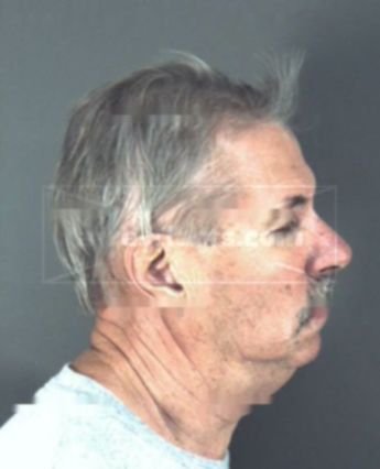 Richard Fredrick Salewske