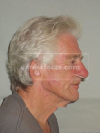 Wayne Thomas