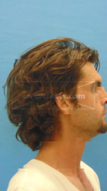 John David Hinkle