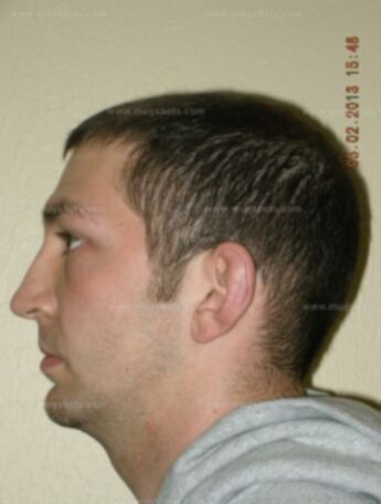 Dalton S Fredrick