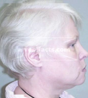 Marjory Jorgenson