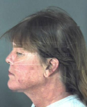 Roxanne Wagner Rose