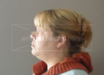 Heidi M Johnson