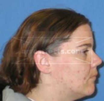 Ashley Renee Schnedler