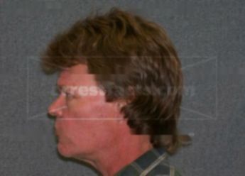 Richard J Murphy