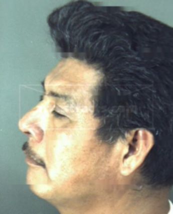 Ignacio Hernandez