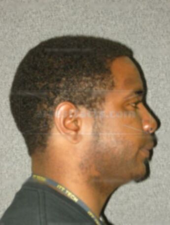 Albert R Williams