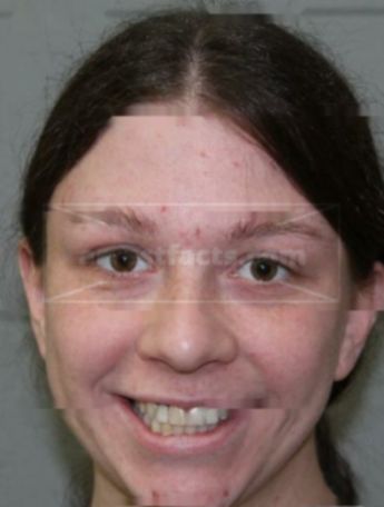 Samantha L Loomans