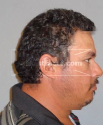 Jose Nunez