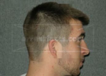 Ryan A Lofink