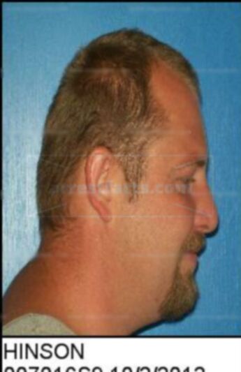 Bobby Allan Hinson