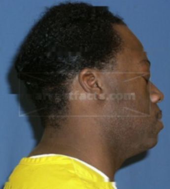 Terrance S Baker