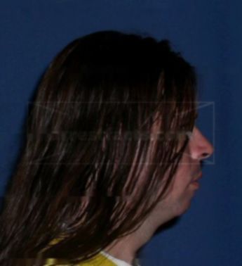 Anthony D Kalan