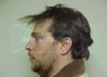 Thomas G Tascier