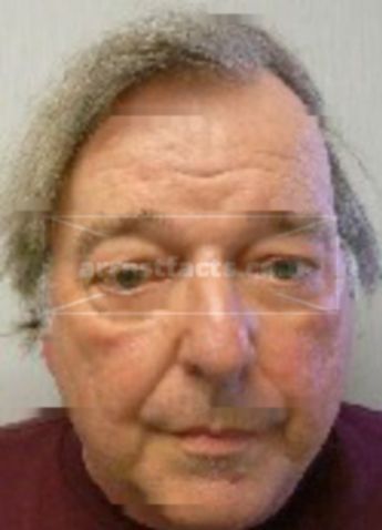 Lawrence M Butler