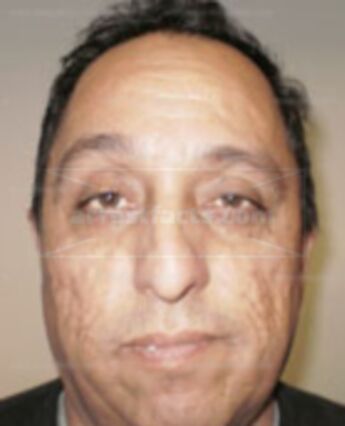 Ronald Avila Nieto
