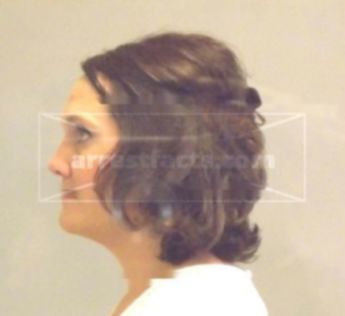 Lisa R Lewis
