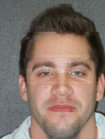 Jacob M Zwiebel