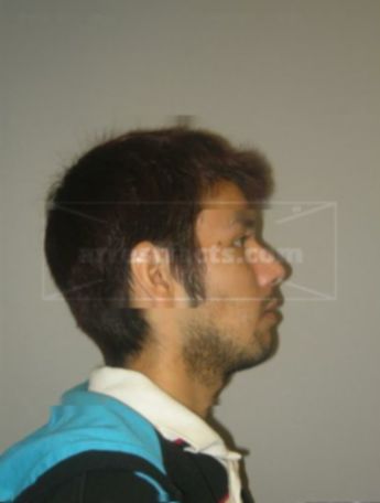 Gilbert H Lyons Ii