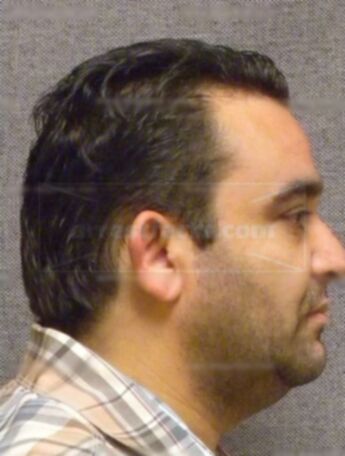 Mohamed A Barketallah