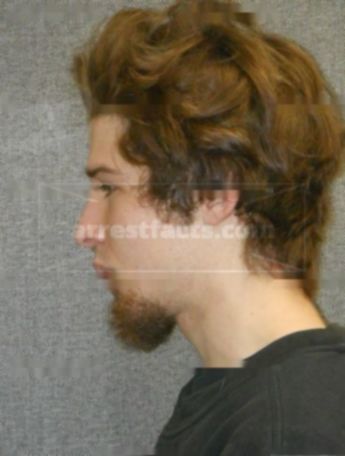 Evan J Snyder