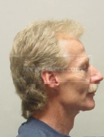 Rickey D Christophersen