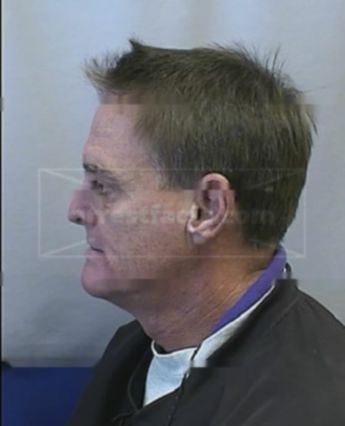 Donald L Dake