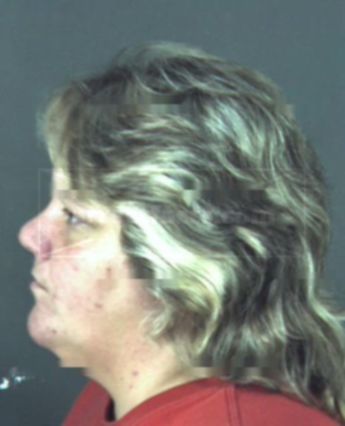 Brenda J Ewen