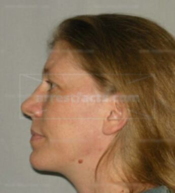 Shawn Louise Bierhals