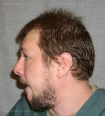 Eric J Kunkel